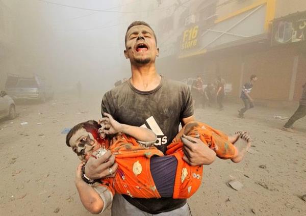 A man carries an injured Palestinian child as Israeli attacks continue