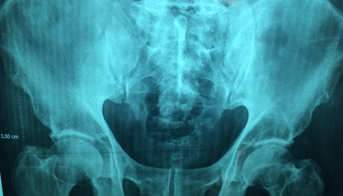 玩家必看教程“开心段子手到底有没有挂”开挂(透视)辅助教程