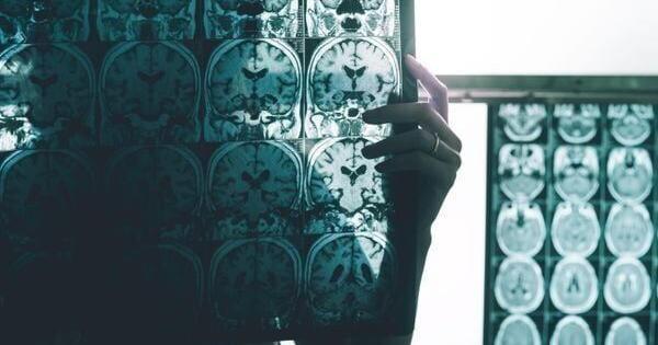 South Korea warns neighbours over planned spy satellite launch South Korea warns neighbours over planned spy satellite launch