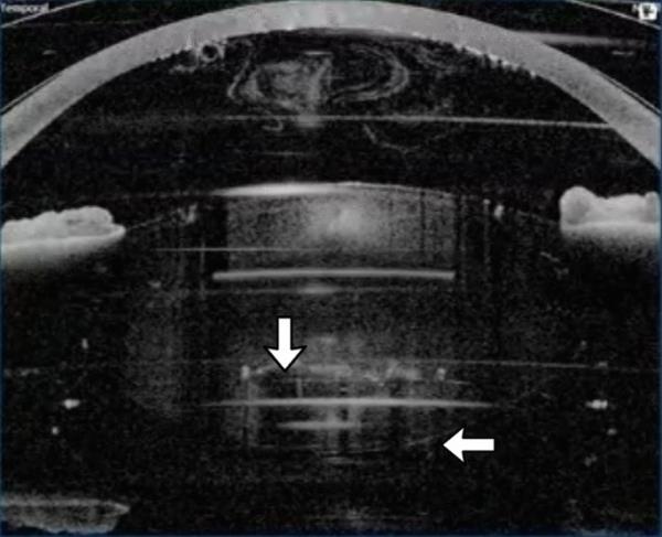 笨手笨脚的熊宝宝爪子卡在树上，佛罗里达警察拿出洗洁精