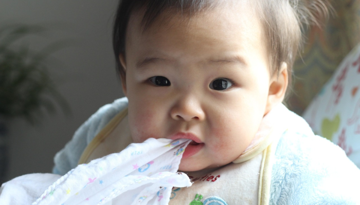 猴痘在儿童,青少年是罕见和很少严重:疾病控制中心 猴痘在儿童,青少年是罕见和很少严重:疾病控制中心