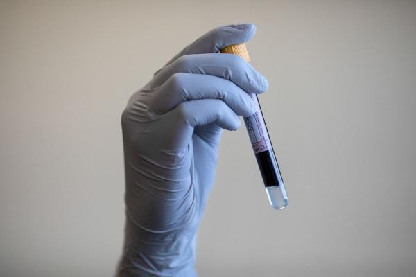伦敦一家医院正在试验一种药物,以保护免疫功能低下的患者免受新冠病毒的侵害 伦敦一家医院正在试验一种药物,以保护免疫功能低下的患者免受新冠病毒的侵害